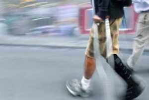 What Are the Common Injuries Sustained in Alabama Pedestrian Accidents?